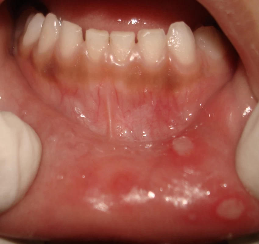 saraswati dental college