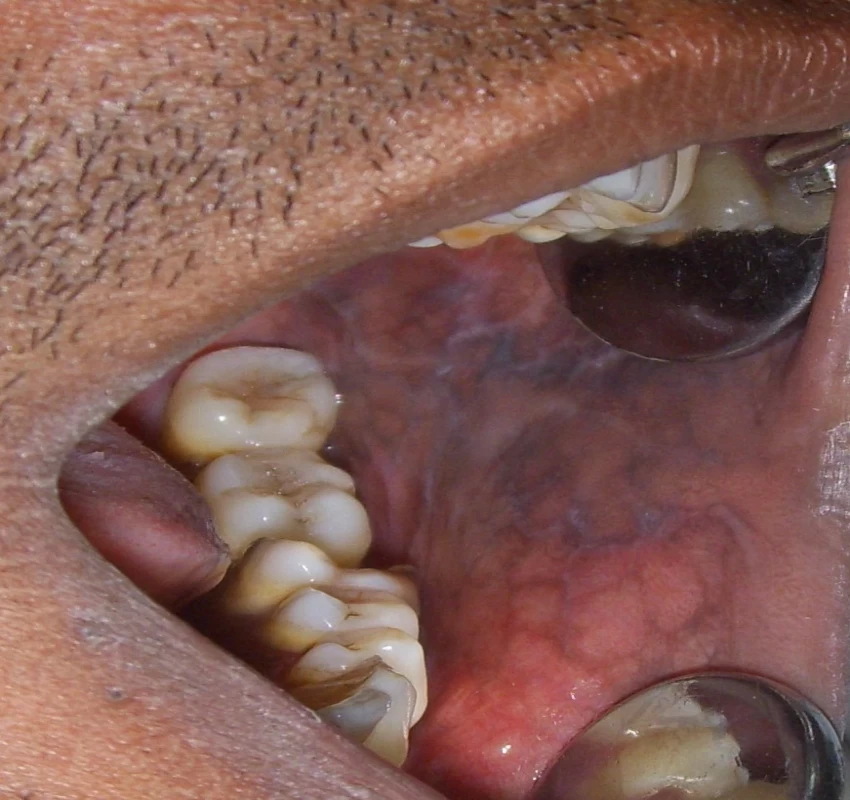 saraswati dental college