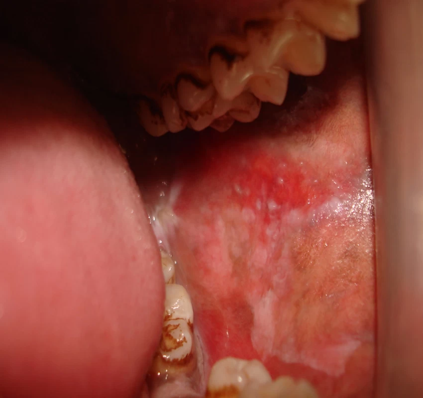 saraswati dental college