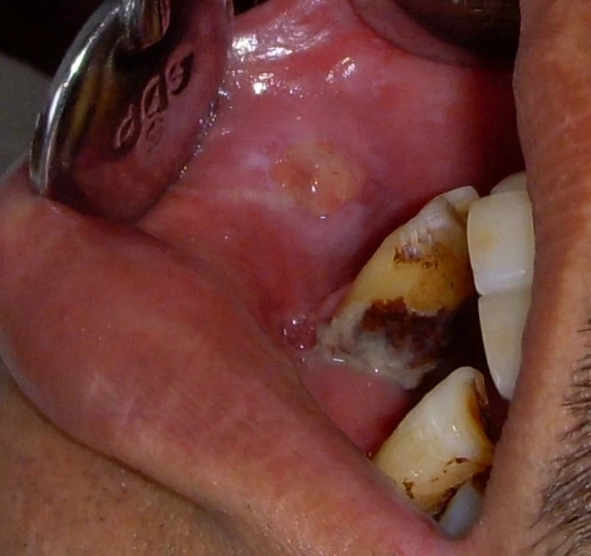 saraswati dental college