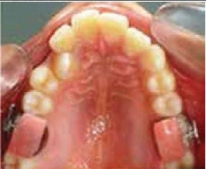 saraswati dental college