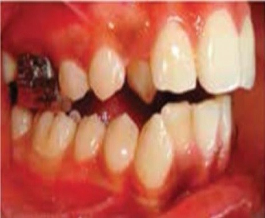 saraswati dental college