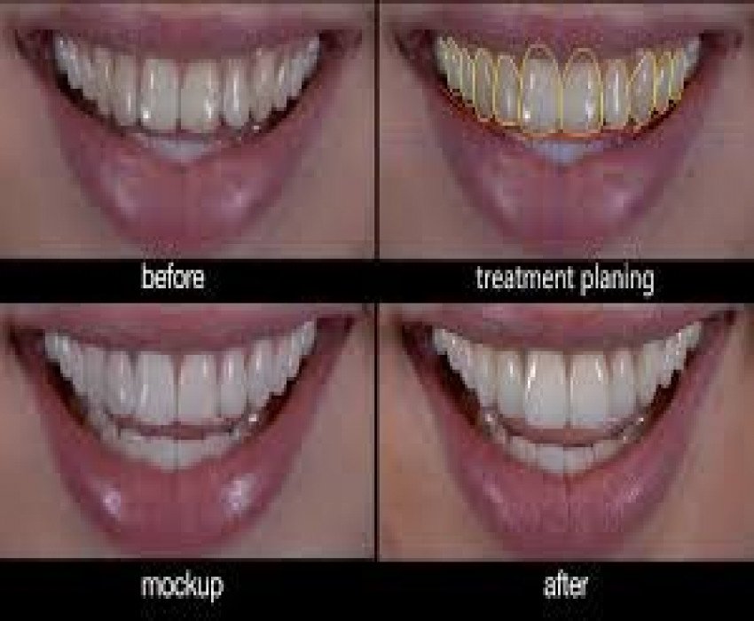 saraswati dental college