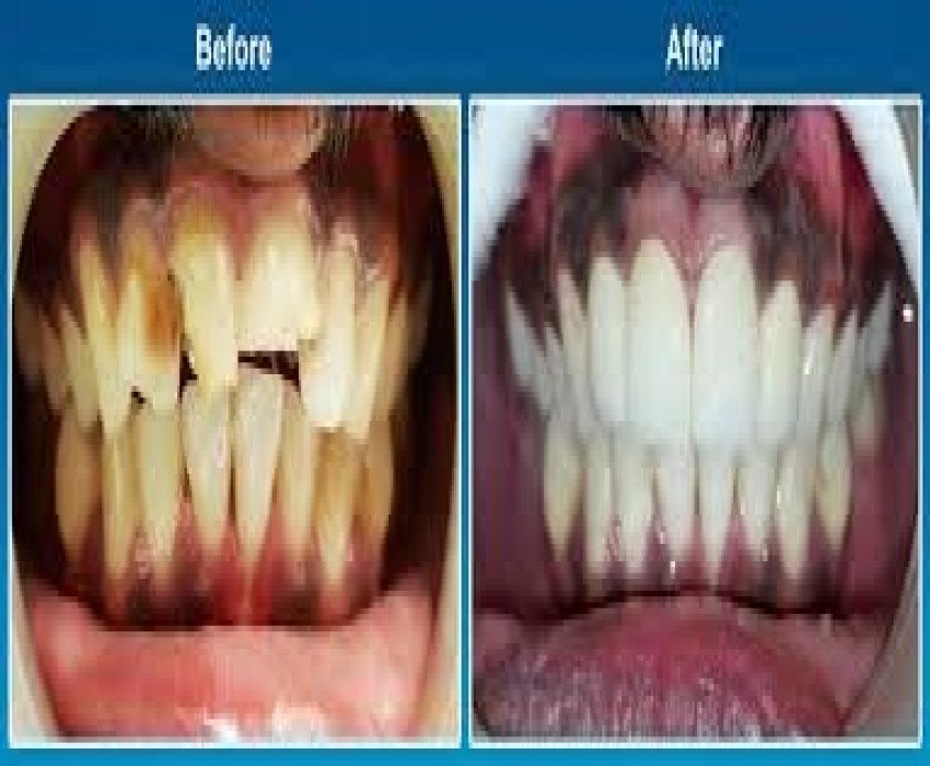 saraswati dental college