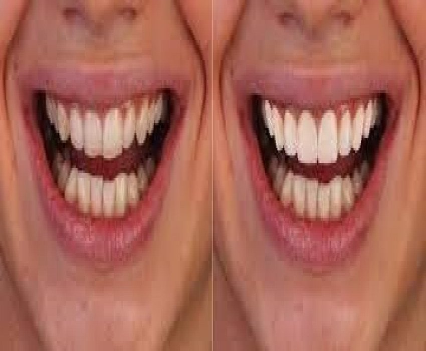 saraswati dental college