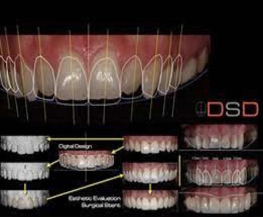 saraswati dental college