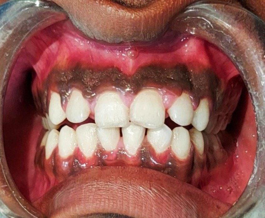 saraswati dental college