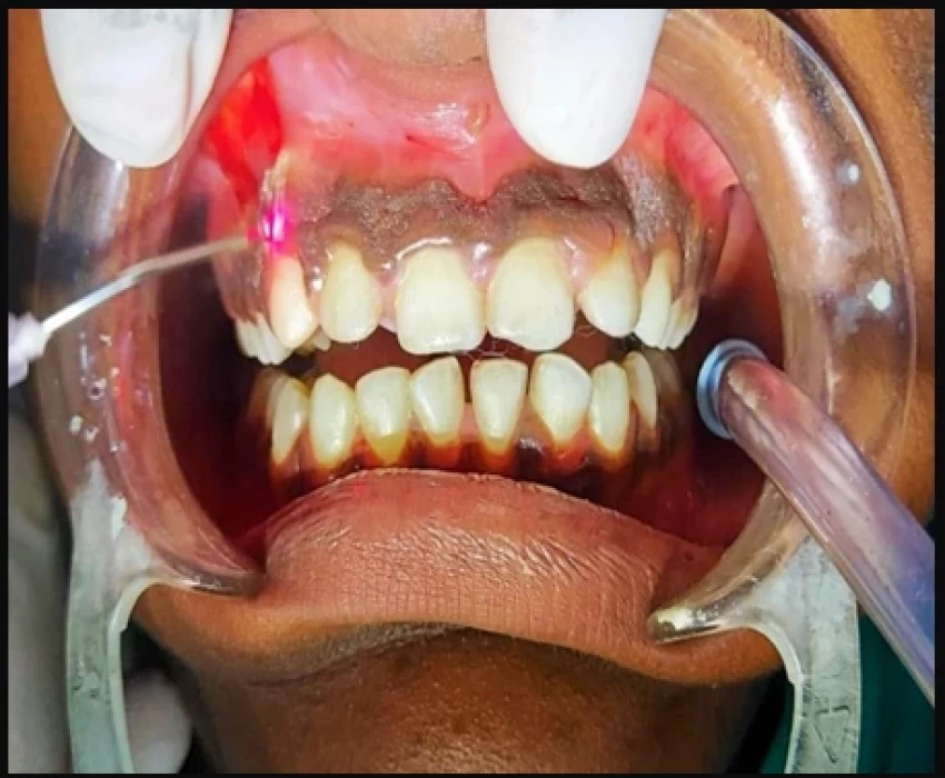 saraswati dental college