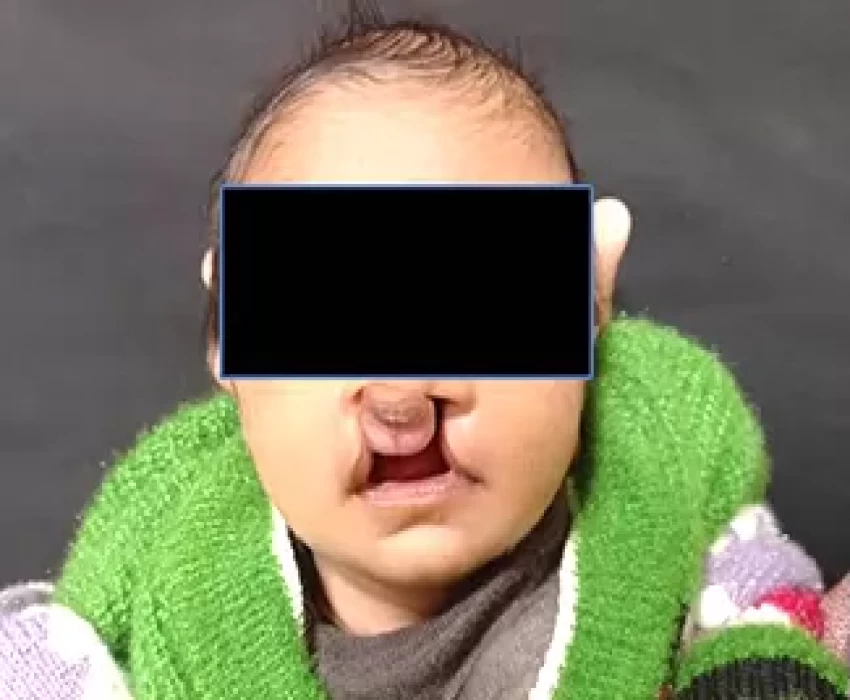 saraswati dental college