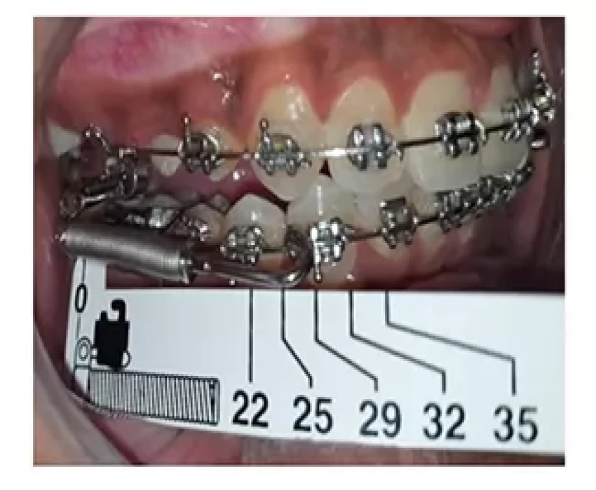 saraswati dental college
