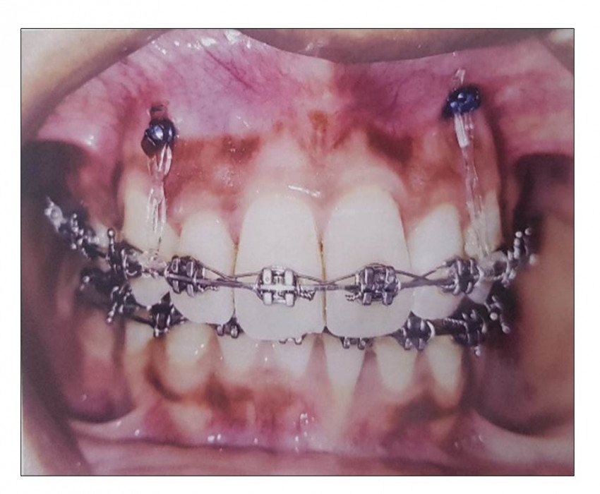 saraswati dental college