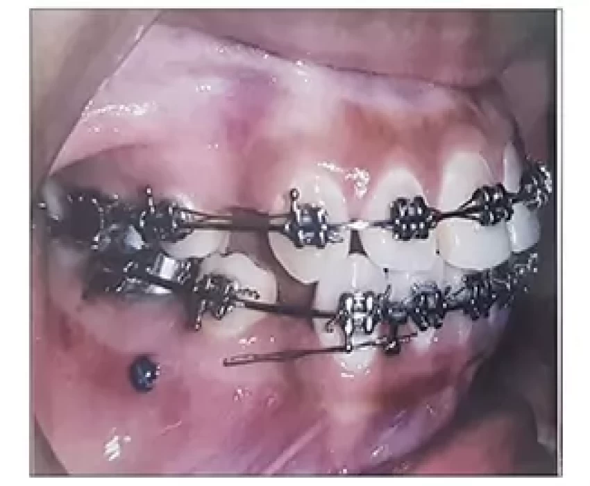 saraswati dental college