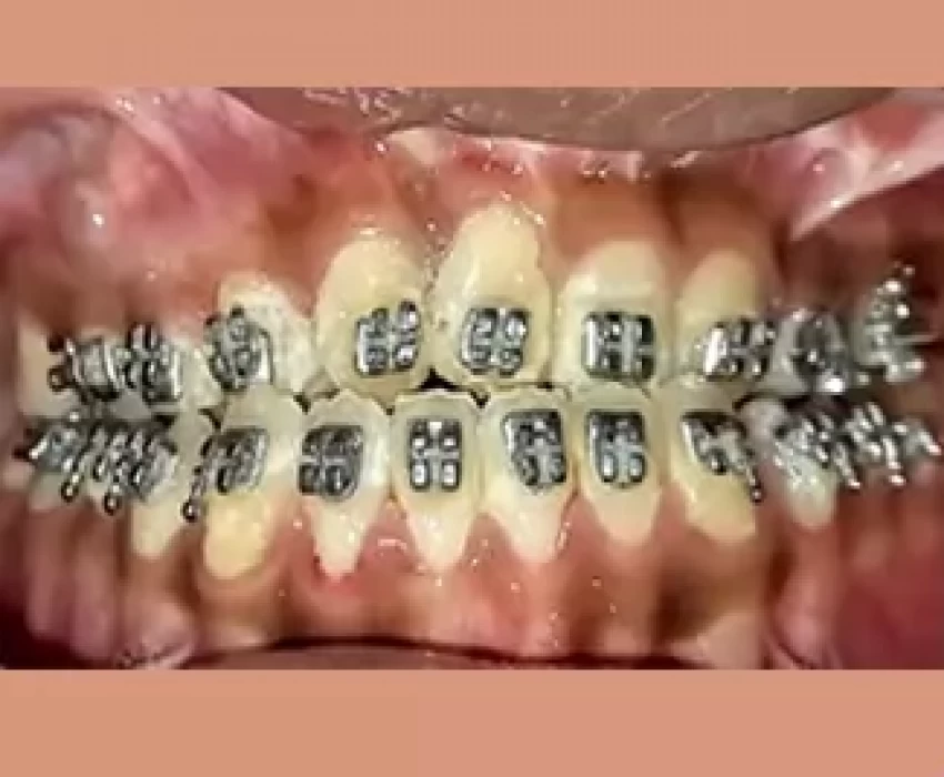 saraswati dental college