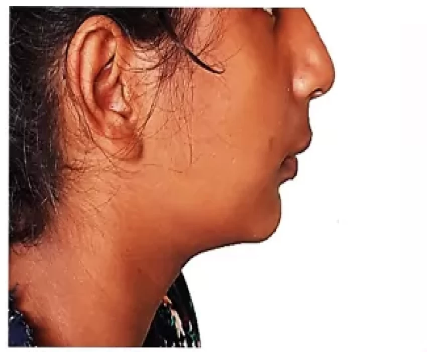 saraswati dental college