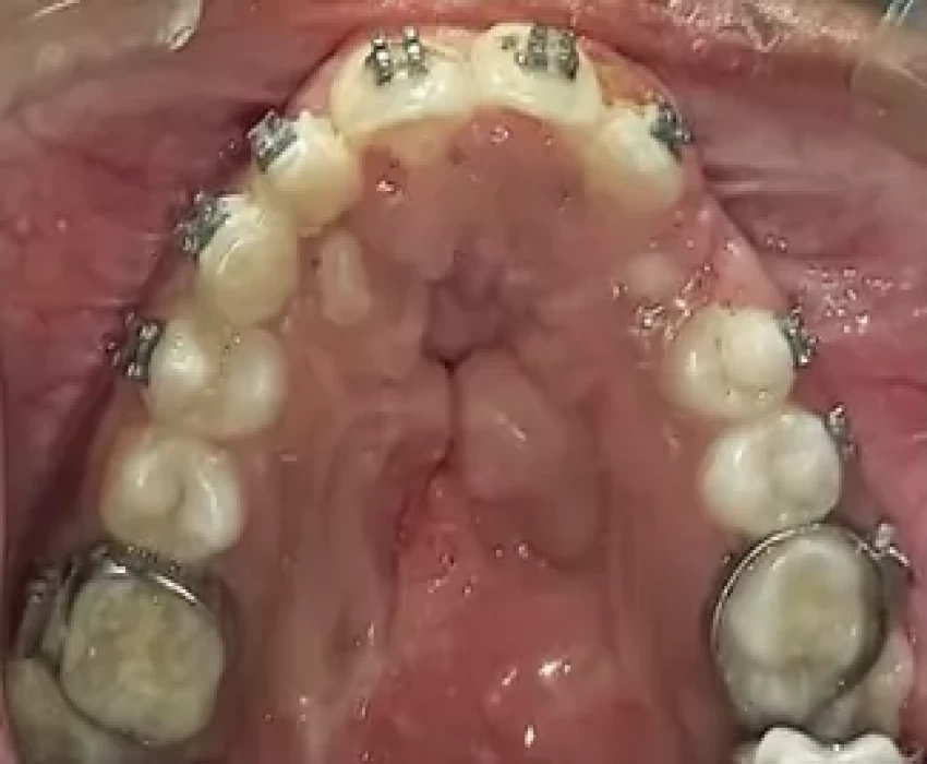 saraswati dental college