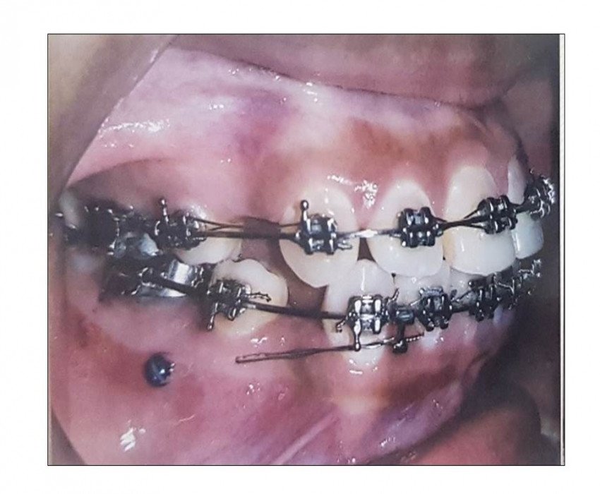 saraswati dental college