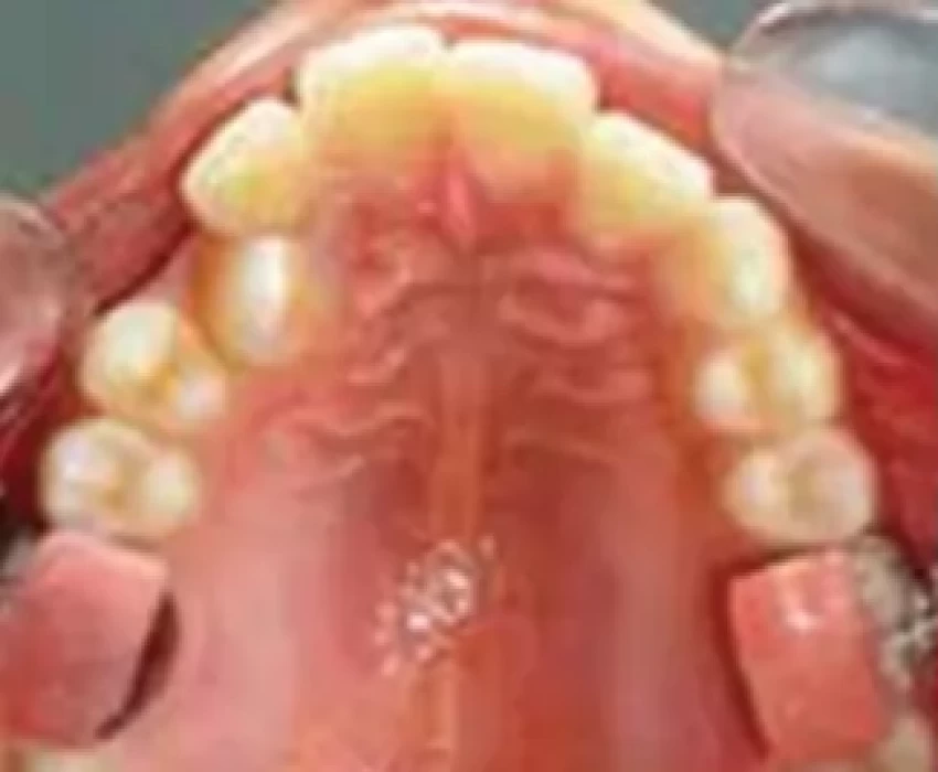 saraswati dental college