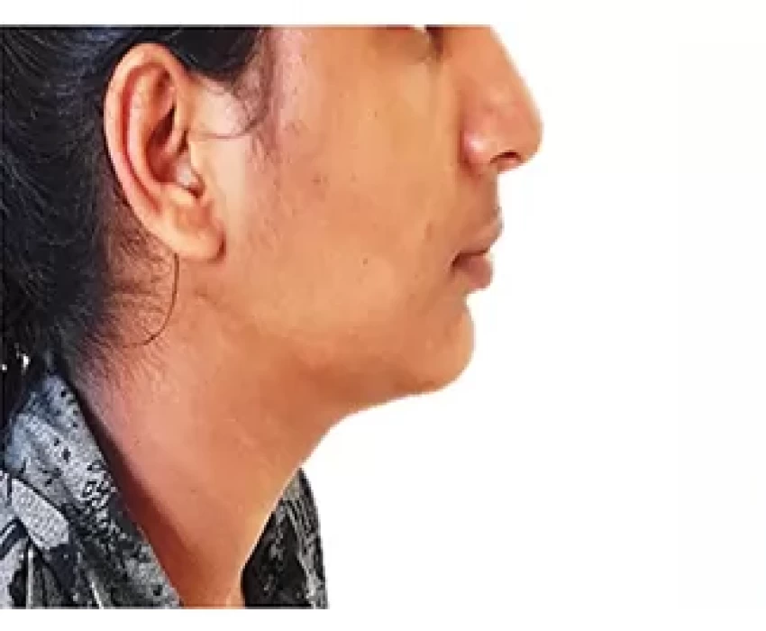 saraswati dental college