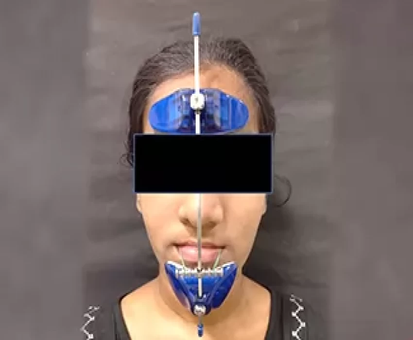 saraswati dental college