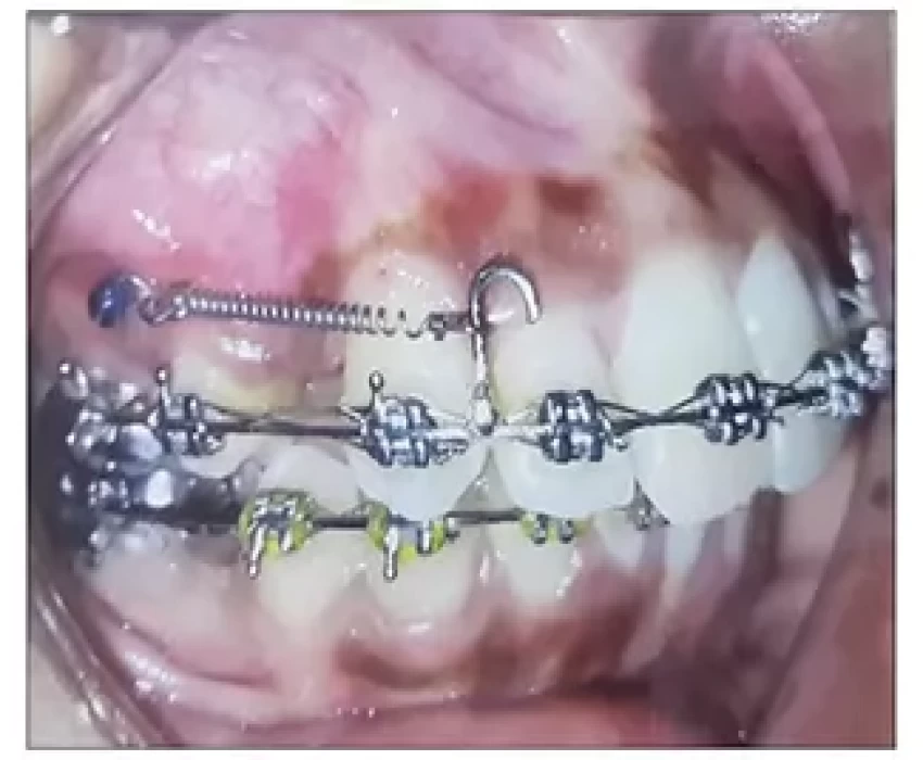 saraswati dental college