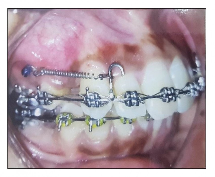 saraswati dental college