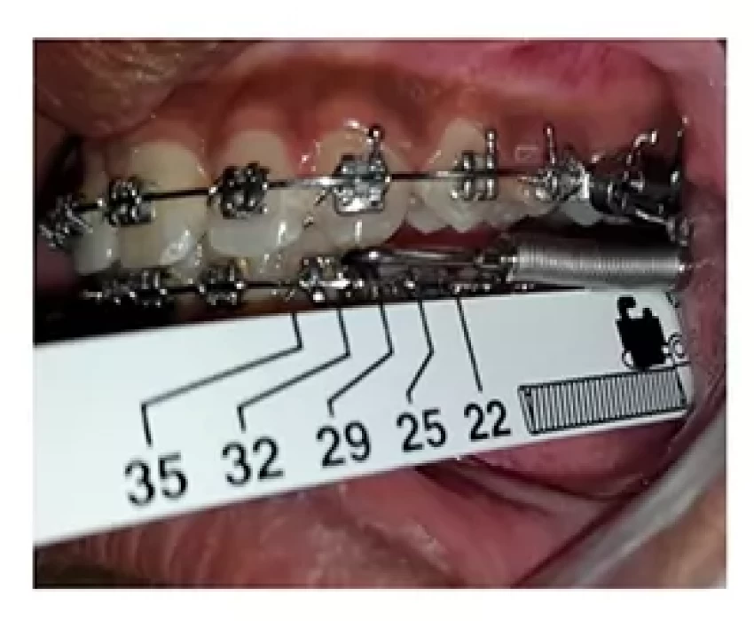 saraswati dental college