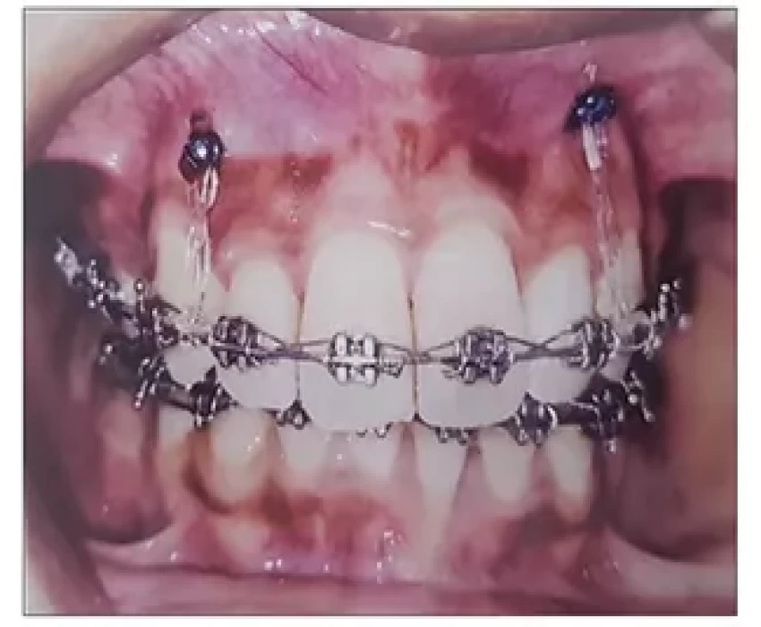 saraswati dental college