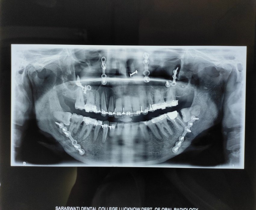 saraswati dental college