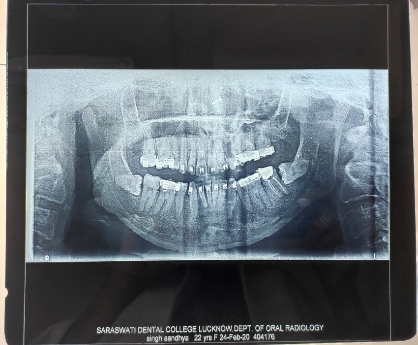 saraswati dental college