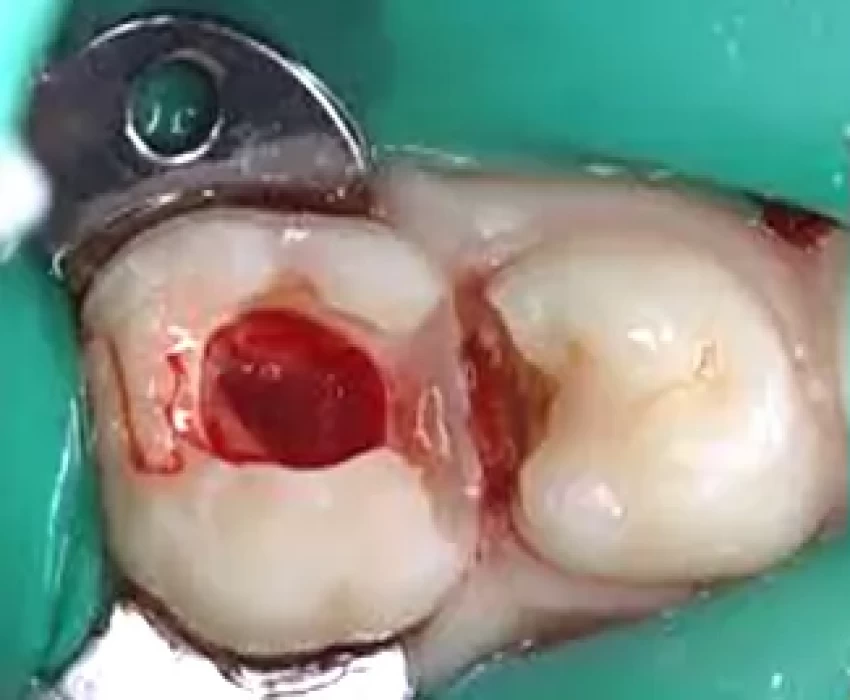 saraswati dental college