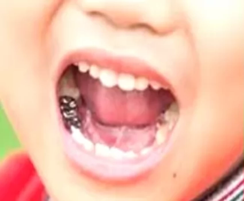 saraswati dental college