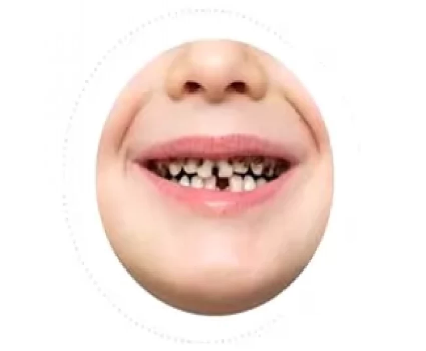 saraswati dental college