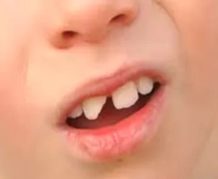 saraswati dental college