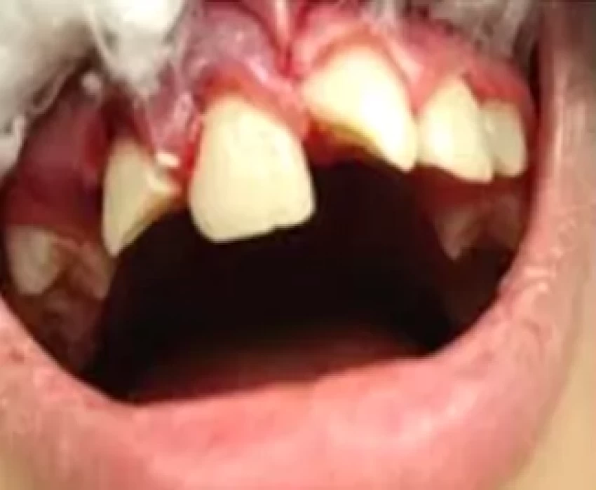 saraswati dental college