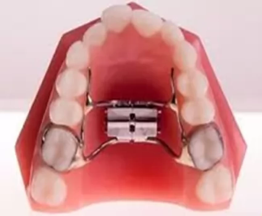 saraswati dental college