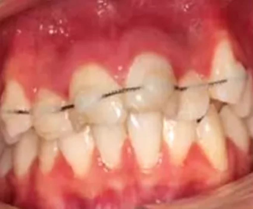 saraswati dental college