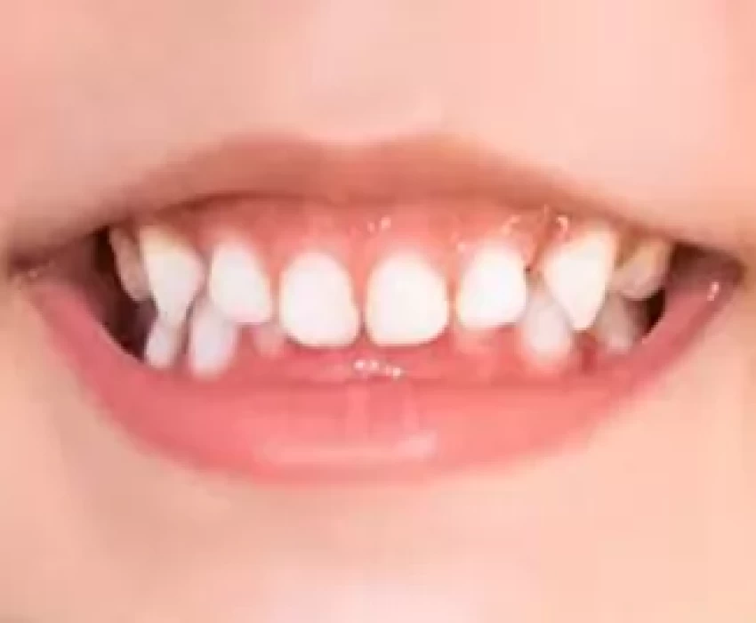 saraswati dental college