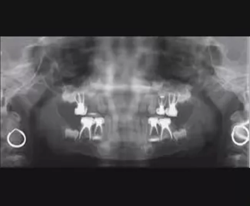 saraswati dental college