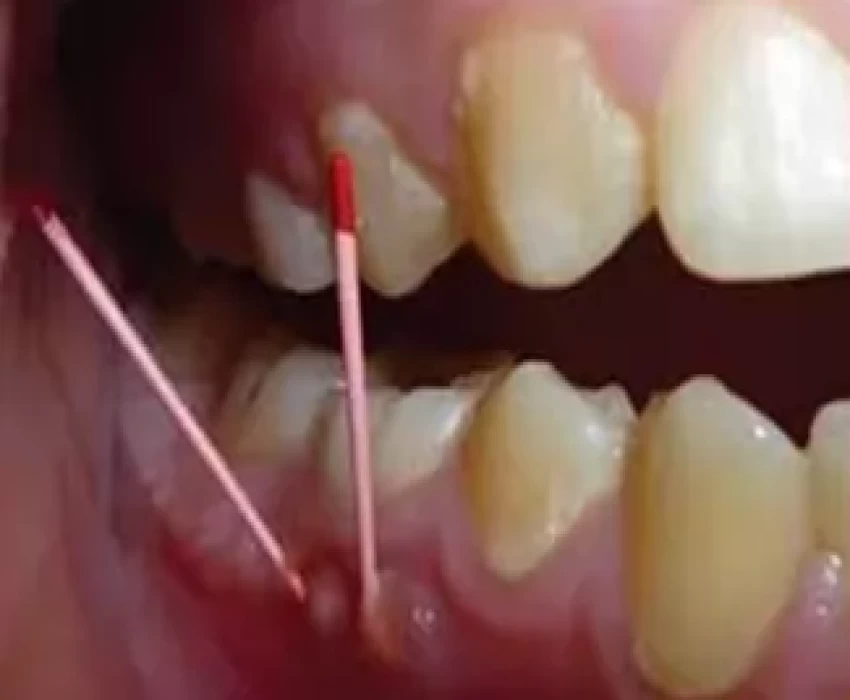 saraswati dental college