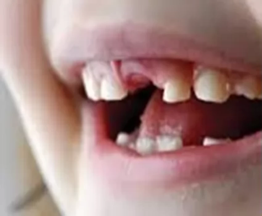 saraswati dental college