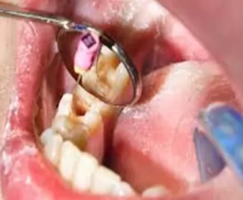 saraswati dental college