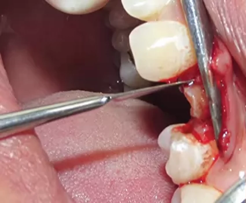 saraswati dental college