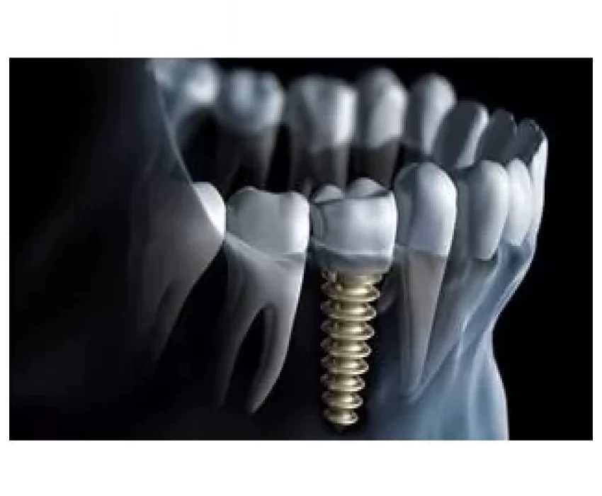 saraswati dental college