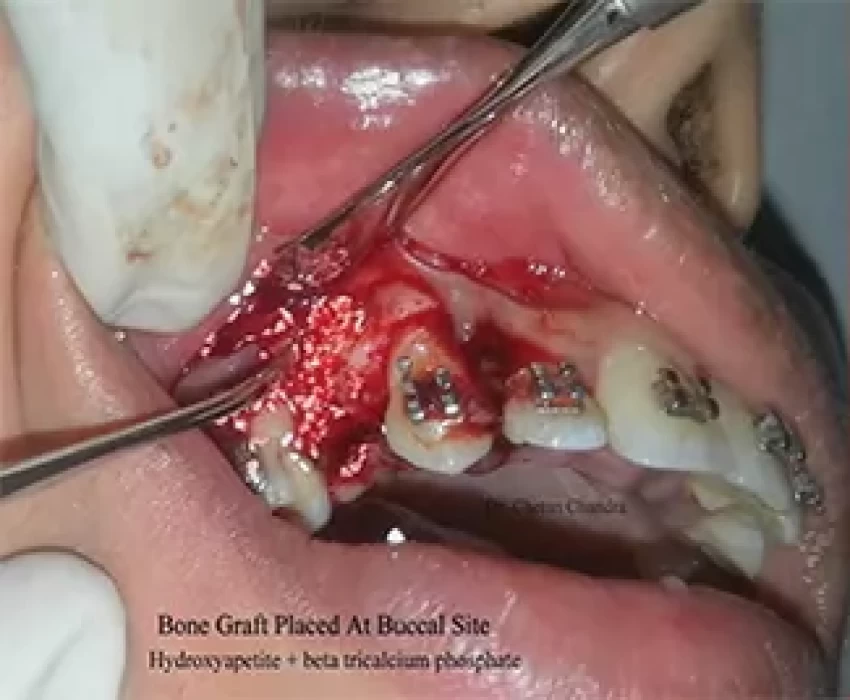 saraswati dental college