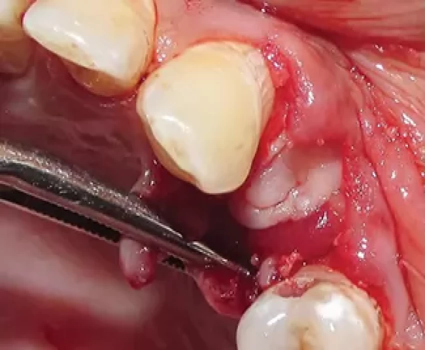 saraswati dental college