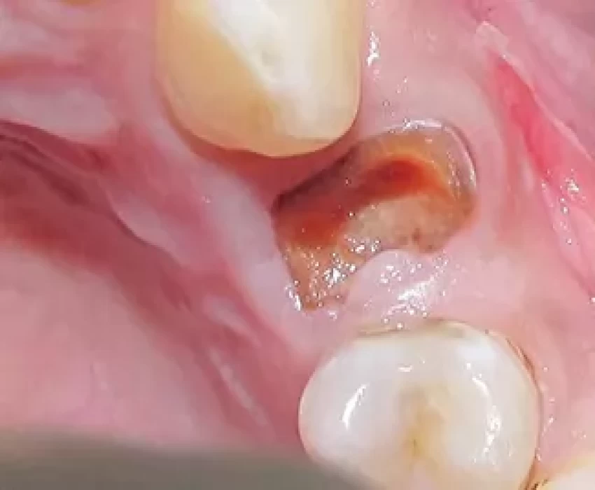 saraswati dental college