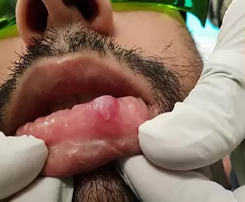 saraswati dental college