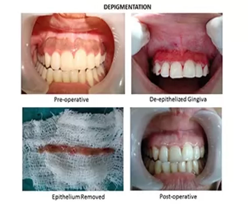 saraswati dental college