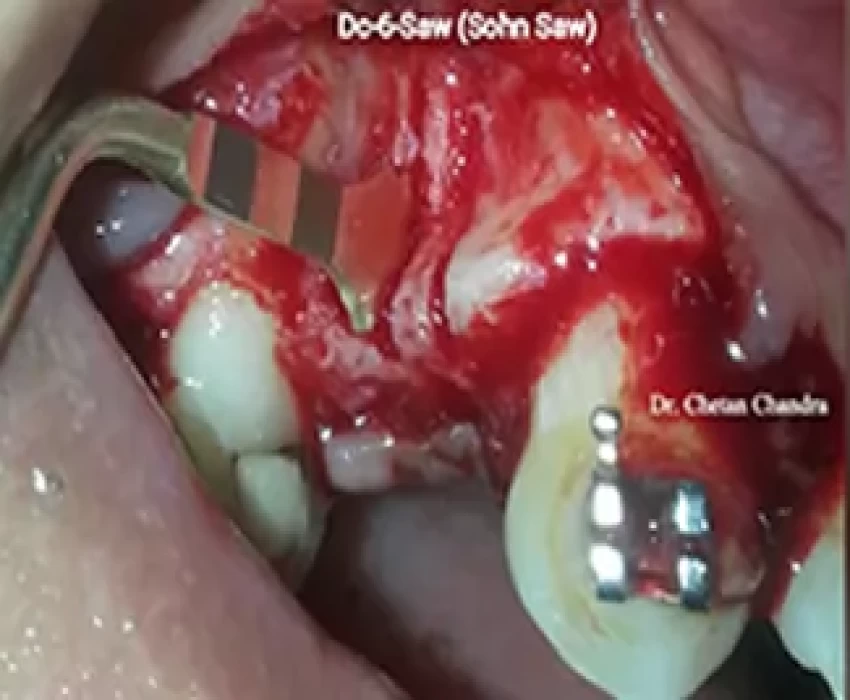 saraswati dental college