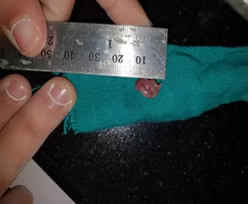 saraswati dental college